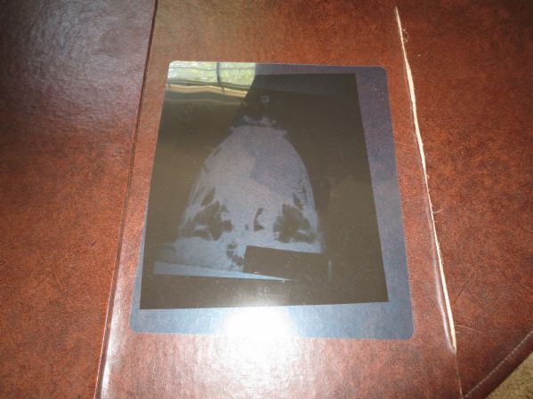 1973 Muhammad Ali Broken Jaw X-ray from Ken Norton Fight  Unusual!